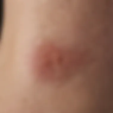 Close-up of skin showing an ingrown hair bump