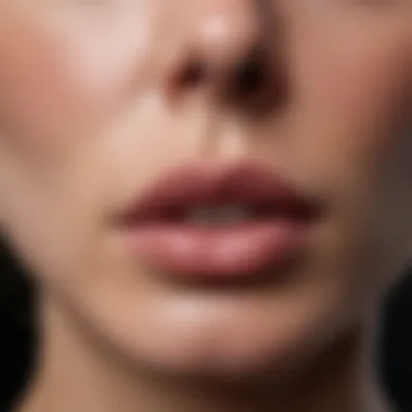 Lip Enhancement Transformation Before and after comparison of lip enhancement procedure
