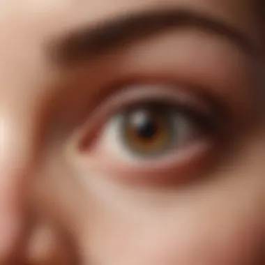 Alleviating Eye Redness with Lumify Illustration of the eye showing redness and how Lumify alleviates it.