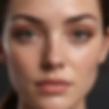 Understanding Skin Types and Acne Diagram showing skin types and acne correlation