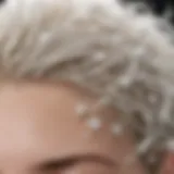 Close-up of dry scalp with white flakes