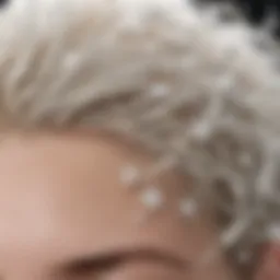 Close-up of dry scalp with white flakes